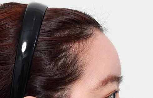 Forehead after using S100